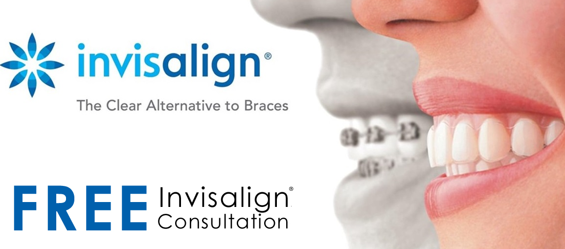 Free Invisalign