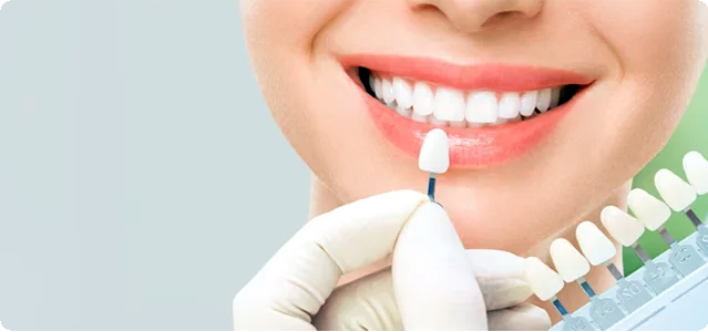 Tooth Whitening