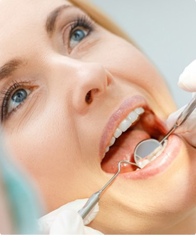 What is the treatment process for Dental Bridges?